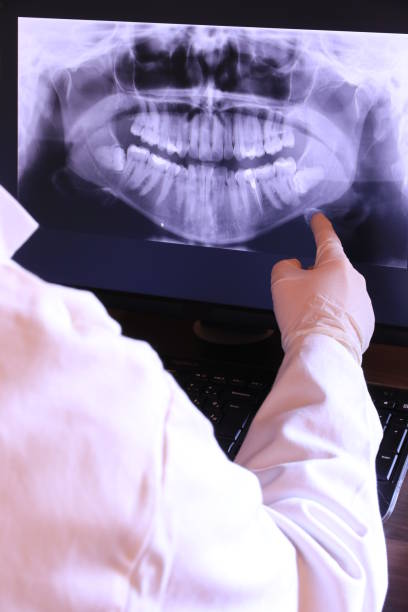 Best Emergency Treatment for Dental Infections or Abscesses in Duchesne, UT